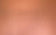 Vegan Skin